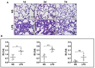 Temporal and Spatial Characterization of Mononuclear Phagocytes in Circulating, Pulmonary Alveolar, and Interstitial Compartments in LPS-Induced Acute Lung Injury